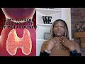 Thyroid Disease Explained: Symptoms, Diagnosis, Treatment &amp; Real Stories