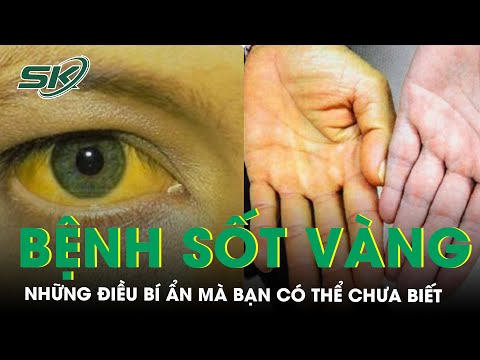 Video: 3 cách điều trị sốt vàng da