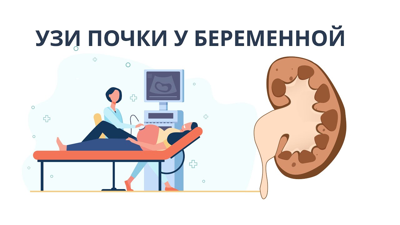 Болит почка беременность неделя. УЗИ почек. УЗИ почек у беременных. Гидронефроз почки УЗИ.