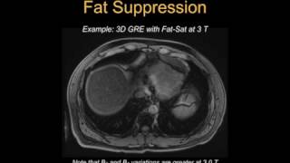 2017 M19 Lecture 19 -Diffusion MRI (Holden Wu, Ph.D.)