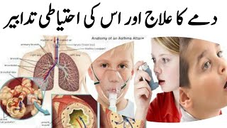 Dama ka ilaj || Dama ka desi ilaj || Dama ki Ehtiyat or Bachao || Healthy tips in urdu hindi