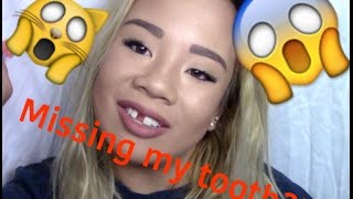 STORYTIME: MISSING TOOTH?!