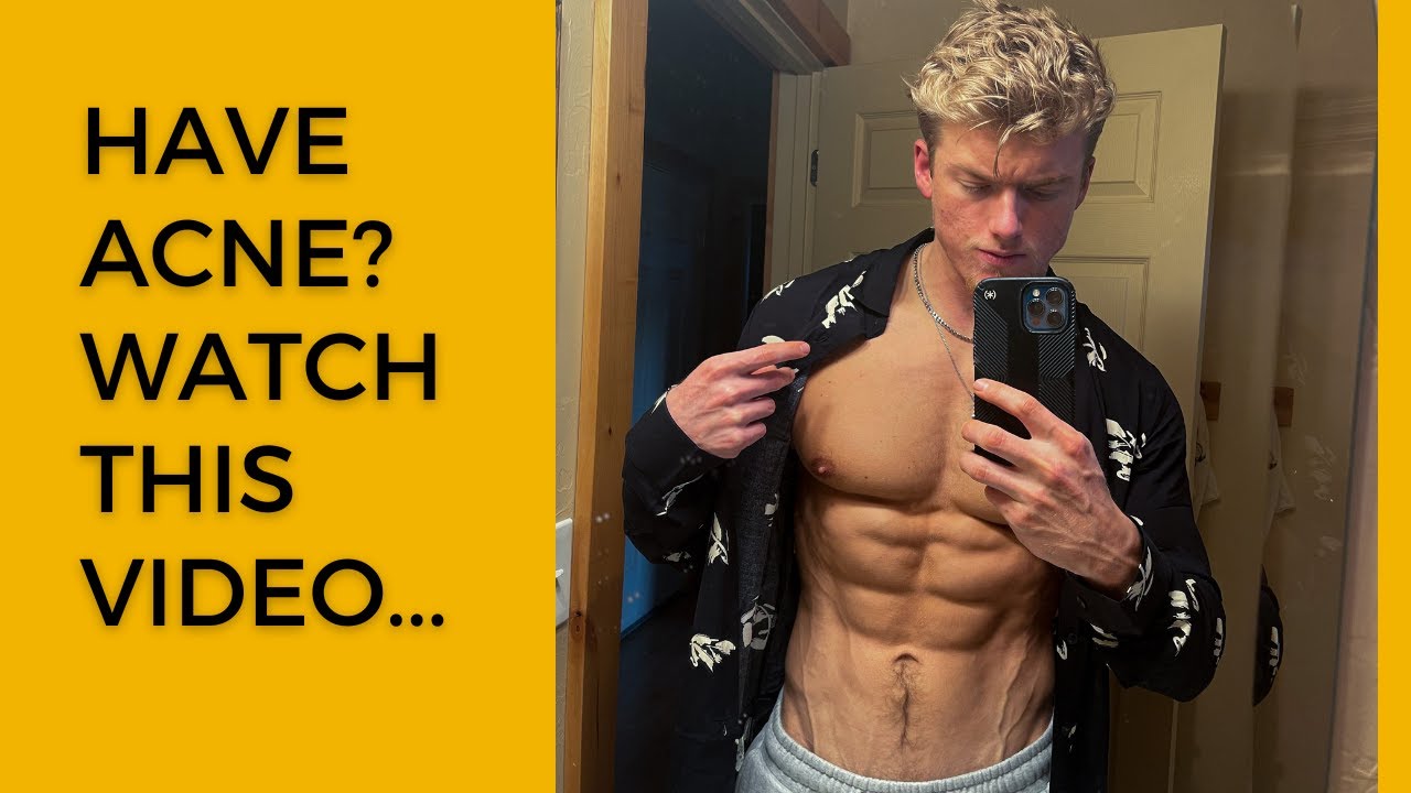 My Experience with Acne and Accutane as a Natural Bodybuilder... YouTube