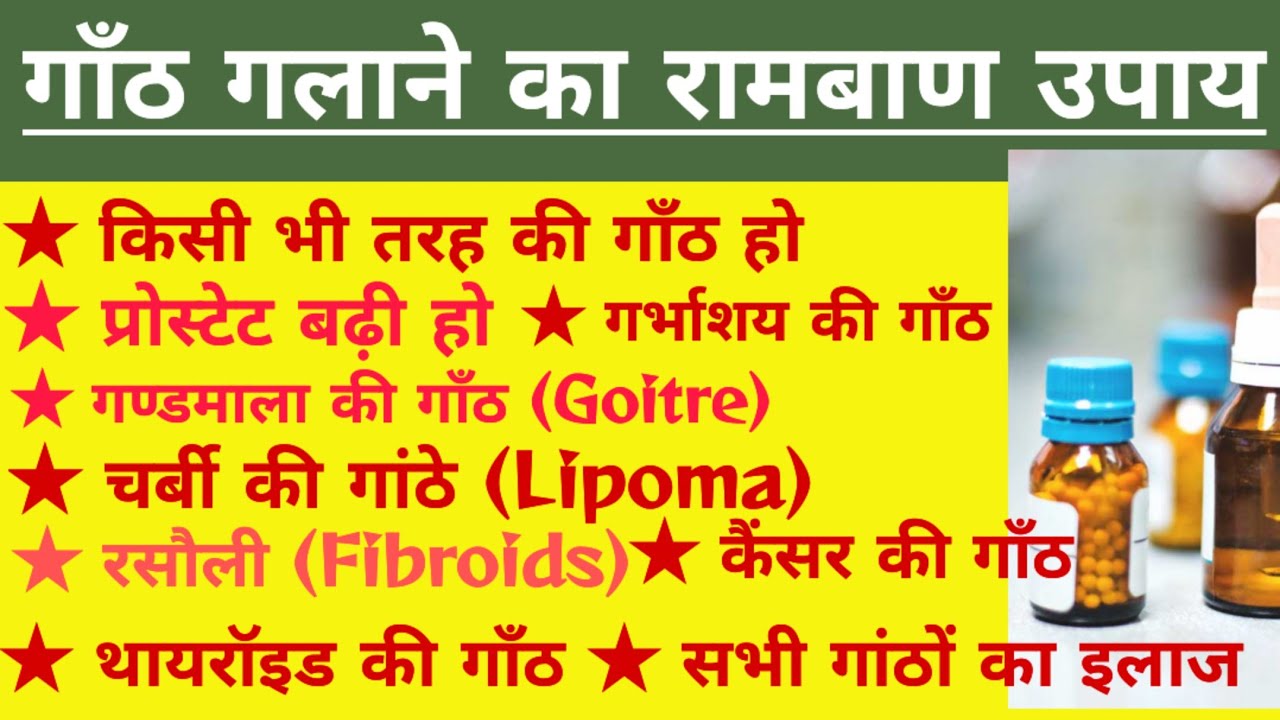 Homeopathic Medicine for Cyst in Ovary in hindi Homeopathic Medicine YouTube
