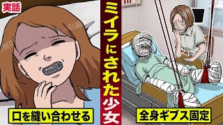 【実話】ミイラにされた少女。口を縫い合わせ...全身をギブスで固定する。
