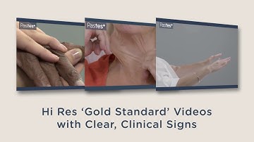 MRCP 2 PACES: Pass first time with Pastest