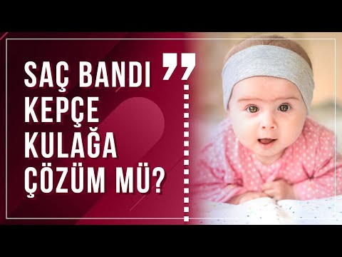 Bebeklere saç bandı takmak kepçe kulakları düzeltebilir mi?