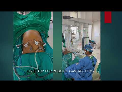 Masterclass on Minimally invasive Radical D2 Gastrectomy for Gastric cancer