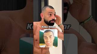 Vücudunda kalıcı hasar bırakılan futbolcular (Part 3) #shorts #futbol