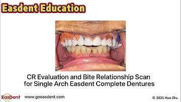 CR Evaluation and Bite Relationship Scan for Single Arch Complete Dentures,