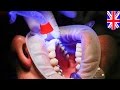 Natural tooth repair: Alzheimer’s drug can stimulate tooth regeneration ...