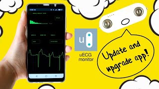 uECG - the new app! Lots of charts added screenshot 1