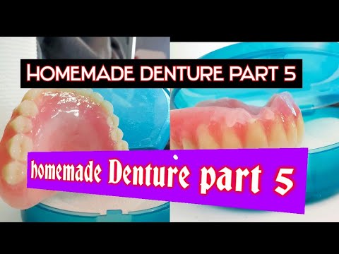 Homemade Denture part 5 ( make your own dentures kit) - YouTube