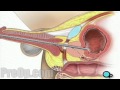 Cystoscopy Male Surgery - Patient Education HD