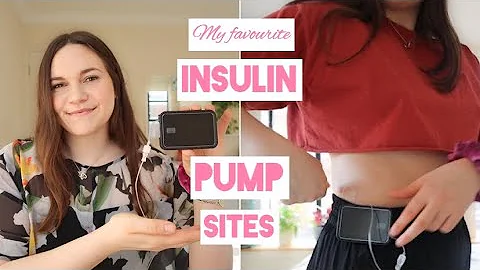 My favourite insulin pump sites | Tandem t:slim x2 infusion sites and cannula options