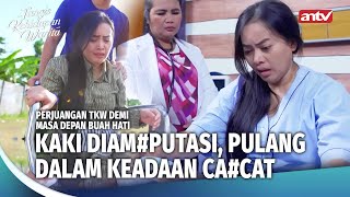 Berangkat Sehat, Pulang Pulang Mengalami Ca#cat | Tangis Kehidupan Wanita ANTV Eps 7 FULL