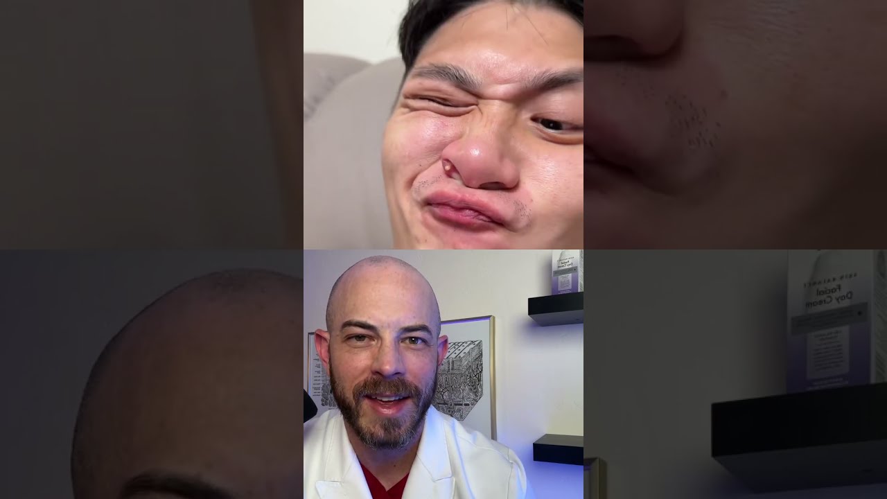 Derm Reacts To Using Facial Contortion Pop Juicy Pimple Dermreacts Doctorreacts Pimplepop