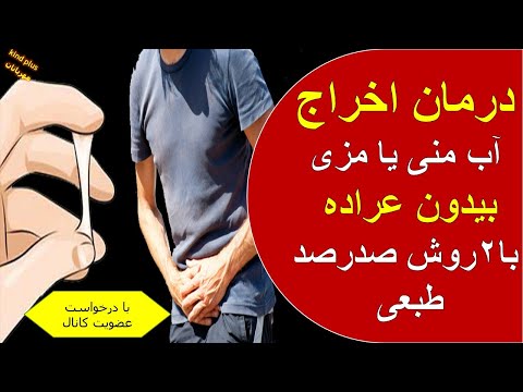 تصویری: چگونه یک مراقب را اخراج کنیم