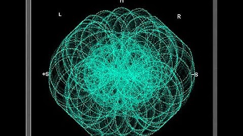 Master Series 2; 44; Phase (Gonio), Correlation Meters 5; Phase and Stereo Field Complications 2