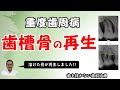 重度歯周病で溶けた骨も再生します あわてて抜歯しないでください 重度歯周病で溶けた骨も再生します あわてて抜歯しないでください