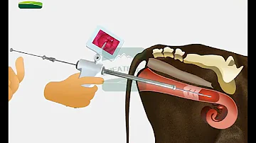 How the artificial insemination gun for cattle works