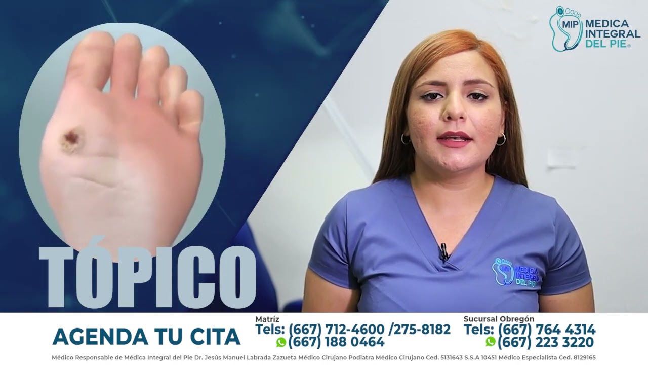 Verruga plantar: qué es, cómo se contagia y cómo curarla