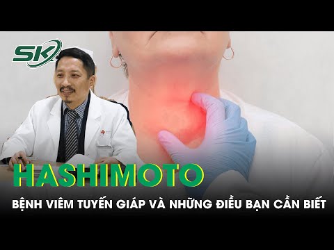 Video: Điều trị bệnh Hashimoto - điều trị nhân quả, điều trị thay thế, nhiễm độc tố