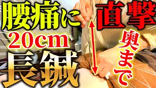 【腰痛 秒で改善 長い鍼】整体 長年のガチガチの腰痛が一秒で改善? ジャズシンガーさんのガッチガチの腰を長い鍼で改善してみました 効果はいかに? 【鍼 ブレア銀座・ブレア元町】 【腰痛 秒で改善 長い鍼】整体 長年のガチガチの腰痛が一秒で改善? ジャズシンガーさんのガッチガチの腰を長い鍼で改善してみました 効果はいかに? 【鍼 ブレア銀座・ブレア元町】