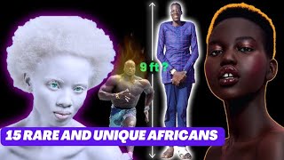 15 Unbelievably Rare/Unique Africans Who Will Shock You.
