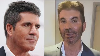 CELEBRITY BEFORE AND AFTER PLASTIC SUERGERY | Simon Cowell |