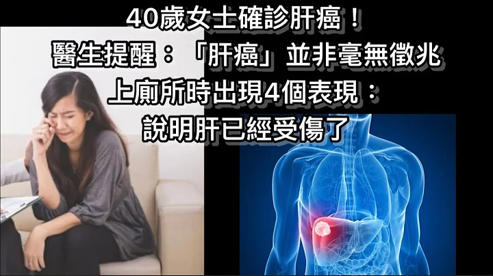 40岁女士确诊肝癌！医生提醒：「肝癌」并非毫无征兆　上厕所时出现4个表现：说明肝已经受伤了 - 天天要闻