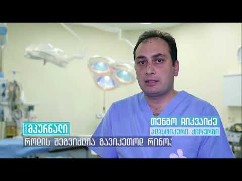 Tengo Chikvaidze - Rhinoplasty,  თენგო ჩიკვაიძე რინოპლასტიკა