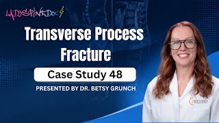 Case study 48 | Transverse Process Fracture | Presented by Dr. Betsy Grunch 