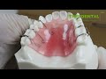 Orthodontic Teaching Model Retainer M3007 video