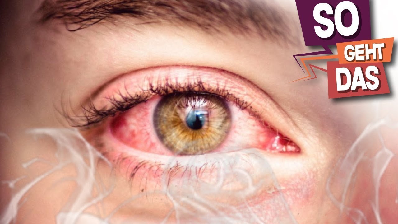 Was Hilft Gegen Rote Augen Nach Dem Kiffen www.youtube.com