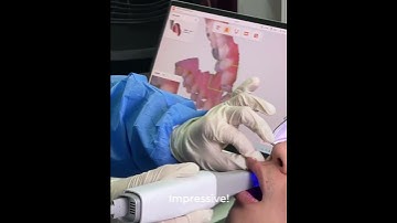 Clariscan UP610，satisfied patients, efficient doctors — a win-win solution.