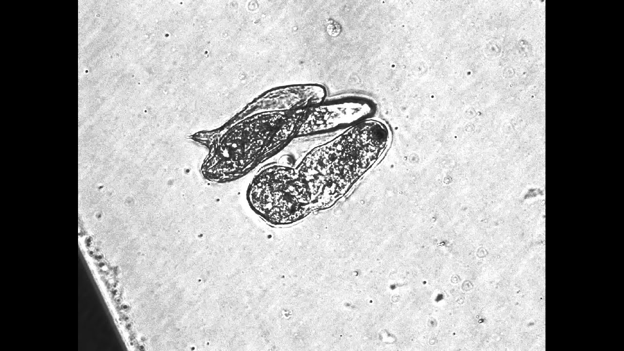 Miracidia of S. mansoni in the ovum/egg.