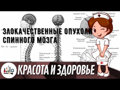 Злокачественные опухоли спинного мозга