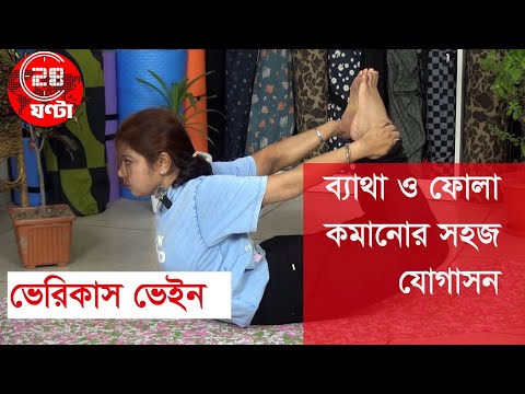 ভেরিকোস ভেইন (Varicose Veins) থেকে মুক্তি: যোগাসন ও সহজ ব্যায়াম | রক্ত সঞ্চালন বাড়ানোর উপায়