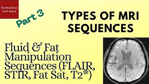 MRI Sequences Explained — Part 3: Fluid & Fat Manipulation Sequences (FLAIR, STIR, Fat Sat, T2*)