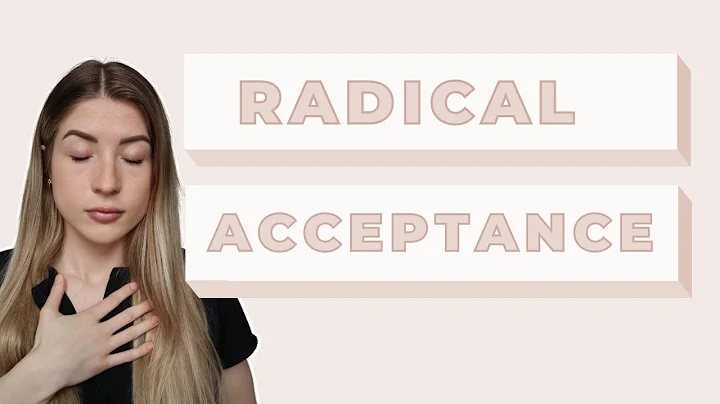 Radical Acceptance (this will change your life!)