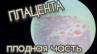 картинка: ПЛАЦЕНТА ПЛОДНАЯ ЧАСТЬ