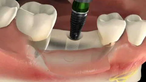O que é uma cirurgia odontológica?
