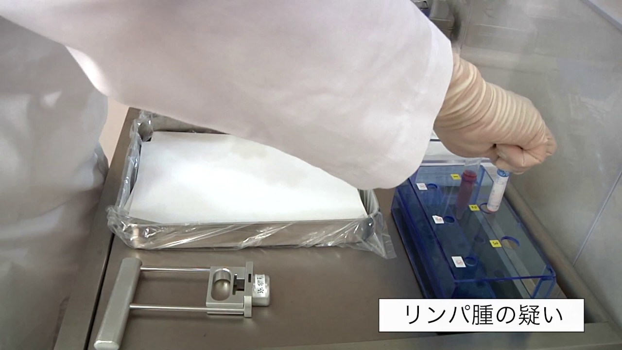 @裁断済 検体採取の手技 穿刺吸引細胞診/穿刺・塗抹のコツ【隈病院】甲状腺専門病院