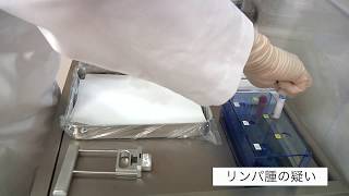 隈病院 穿刺吸引細胞診 穿刺・塗抹のコツ