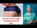 مفهوم المؤخرة البرازيلية Brazilian Butt Lift BBL