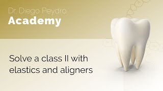 Solve a Class II with elastics and aligners