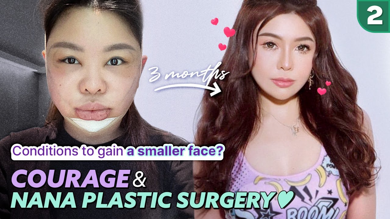 [SUB] Face contouring 3 Months PostOP REVIEW! Korea plastic surgery