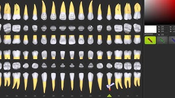 Odontograma actualizado