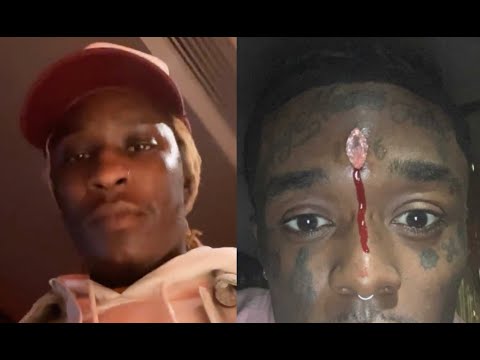 Young Thug Reacts To Lil Uzi Vert Forehead Bleeding After Getting 24M Diamond Implant